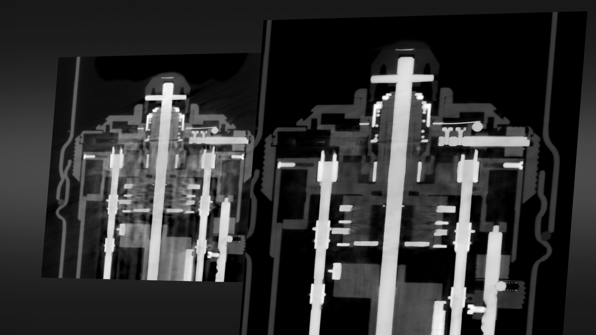Авангардна редукция на артефакти при смесени материали (AMMAR)​