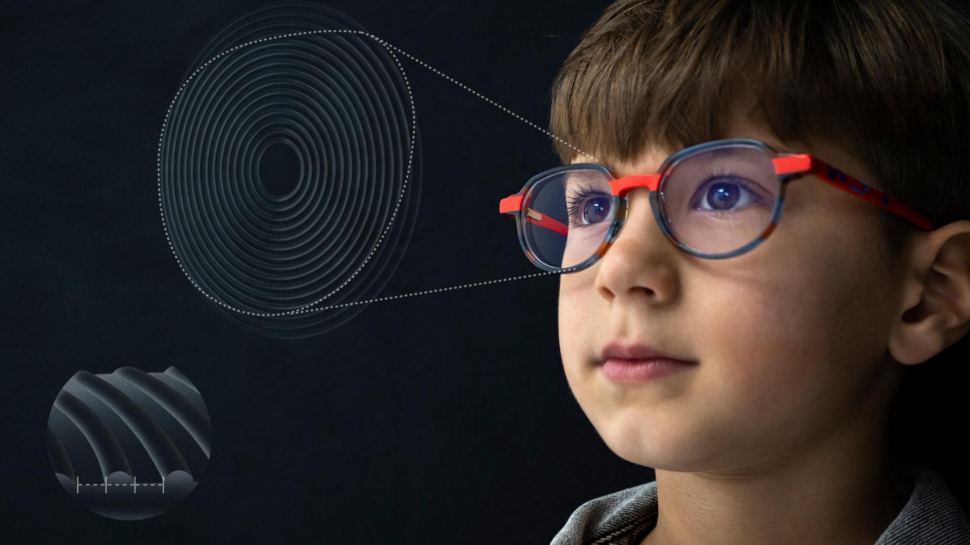 Илюстрация в близък план на дизайна на лещите ZEISS MyoCare за лечение на късогледство при деца.